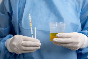 Leia mais sobre o artigo Qual cor da urina é preocupante?